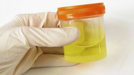 Sdacha-analiza-mochi2